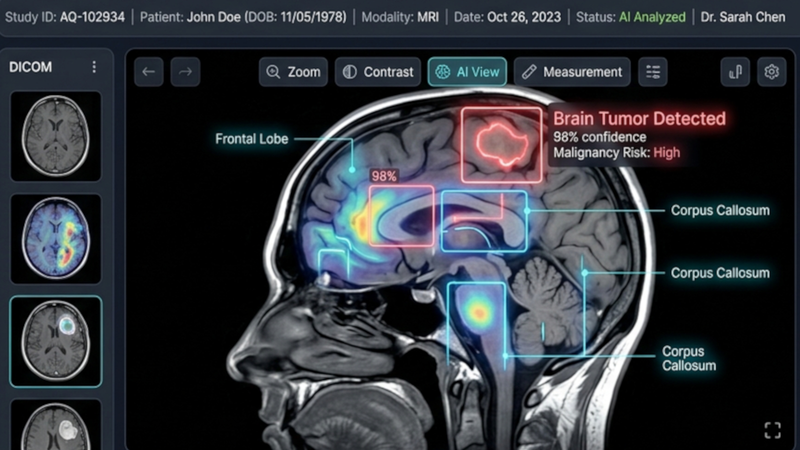 AQUILA AI-powered DICOM imaging platform for radiology